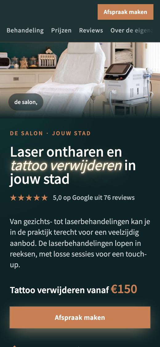 Nieuwe pagina: Tattoo verwijderen, vanaf €150